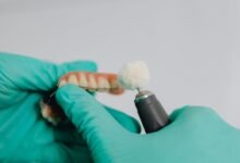 hungary dental implant services